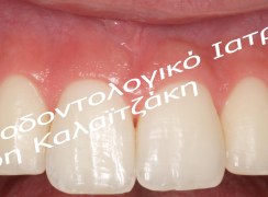 IMG_3736_ΝΜ
