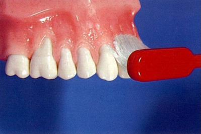 Περιστροφική κίνηση της οδοντόβουρτσας