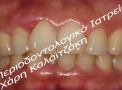 IMG_0536_GE