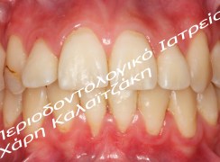 IMG_3466_SB