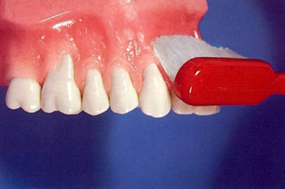 Αρχική τοποθέτηση της οδοντόβουρτσας με γωνία 45ο