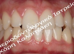 IMG_3963_ΒΚ
