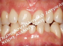 IMG_3615_KD