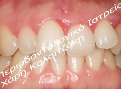 IMG_2292_KG